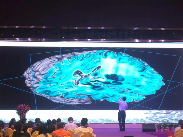 【醉木苑红木】小叶紫檀的养生功效你知道多少？